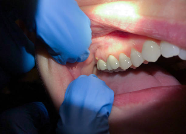 Lexington, VA Emergency Dentist Pros