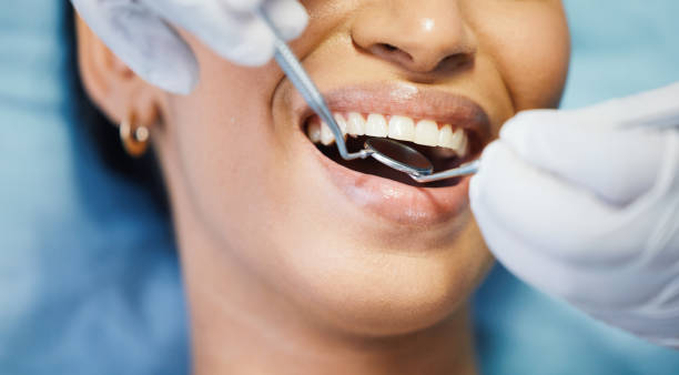 Best Emergency Tooth Extraction in Lexington, VA