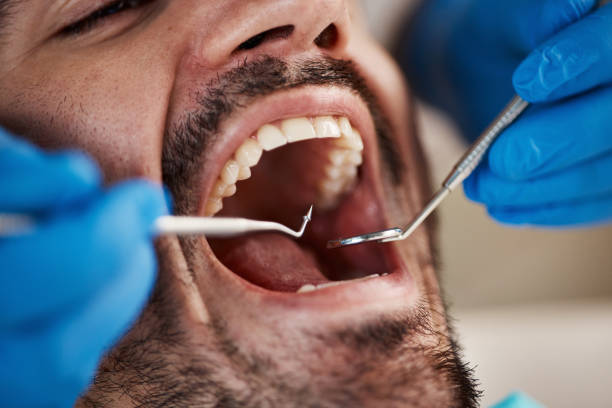 Best Emergency Denture Repair in Lexington, VA