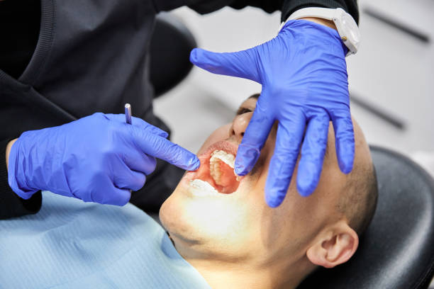 Best Emergency Treatment for Dental Infections or Abscesses in Lexington, VA